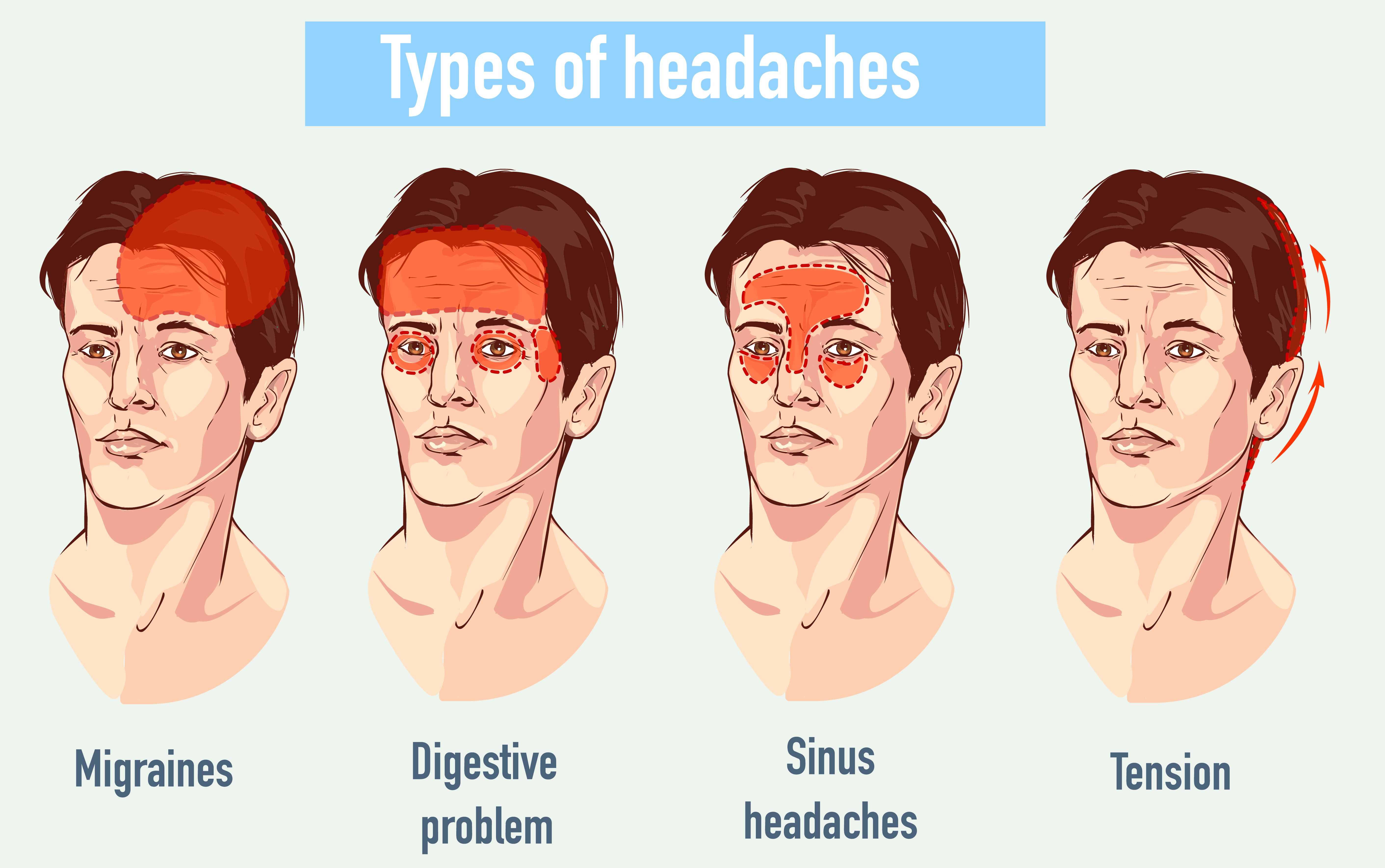 An Innocent Headache Could Be FATAL Here s How To Spot The Warning 