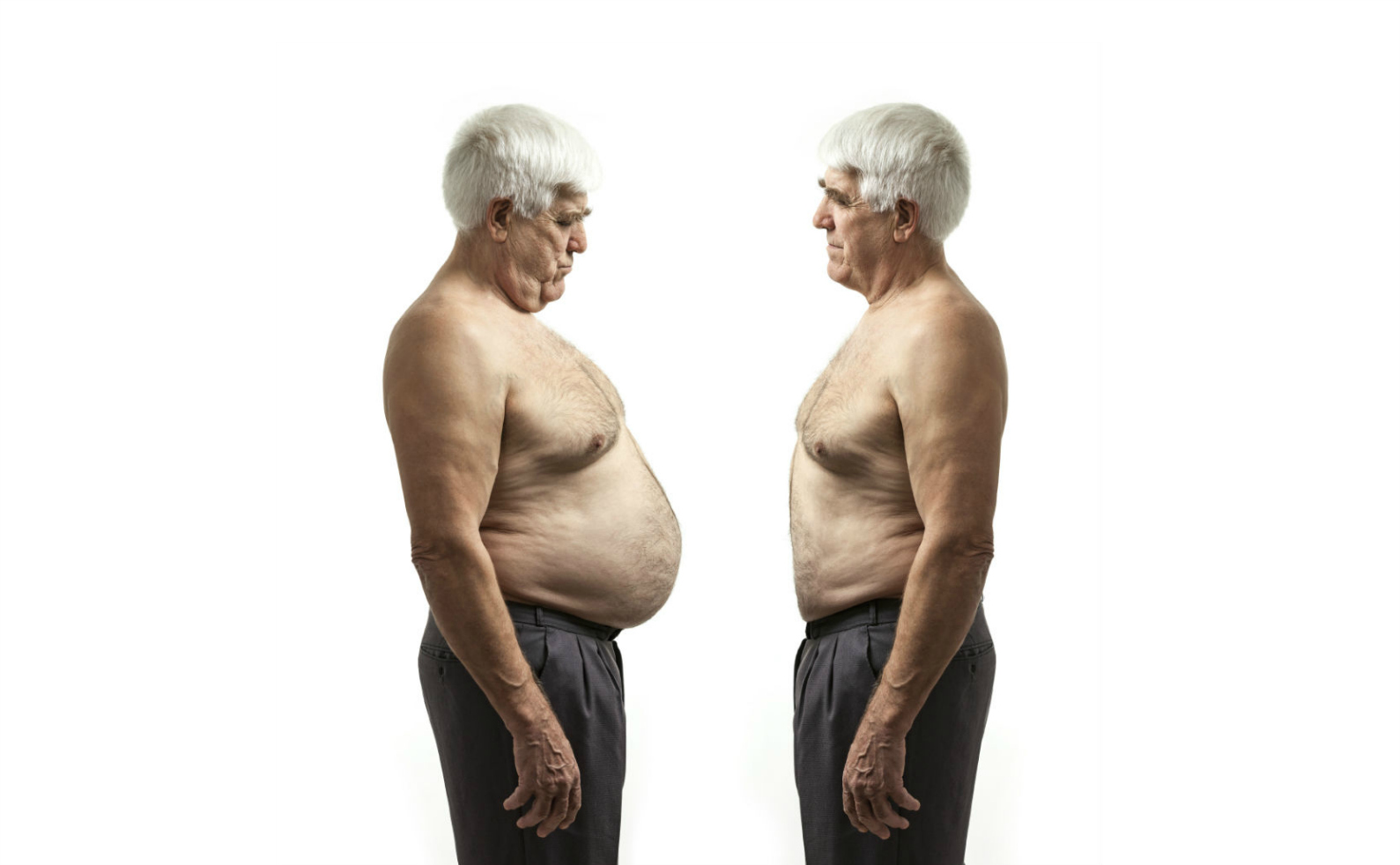 Толстый пожилых мужчин. Саркопения ожирения.