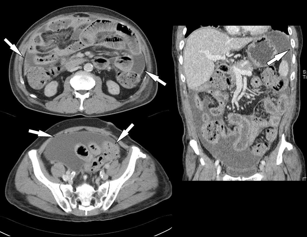 How To Read CT Scan CT Abdomen Faculty of Medicine