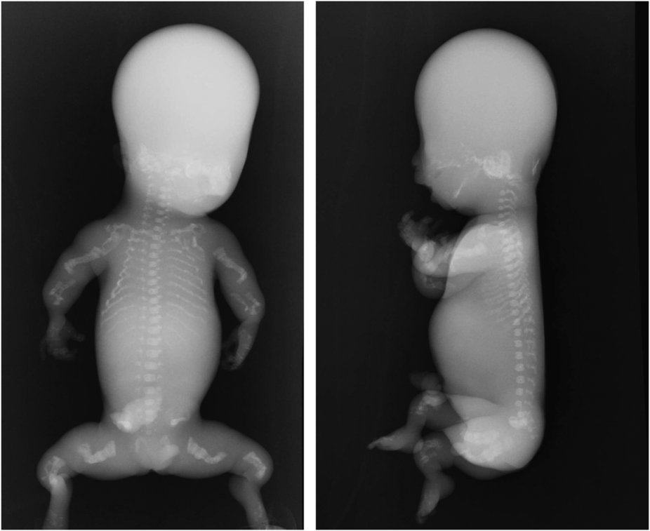 Baby Xray Faculty of Medicine