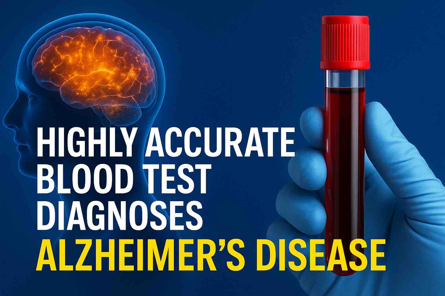 alzheimer’s blood test .jpg