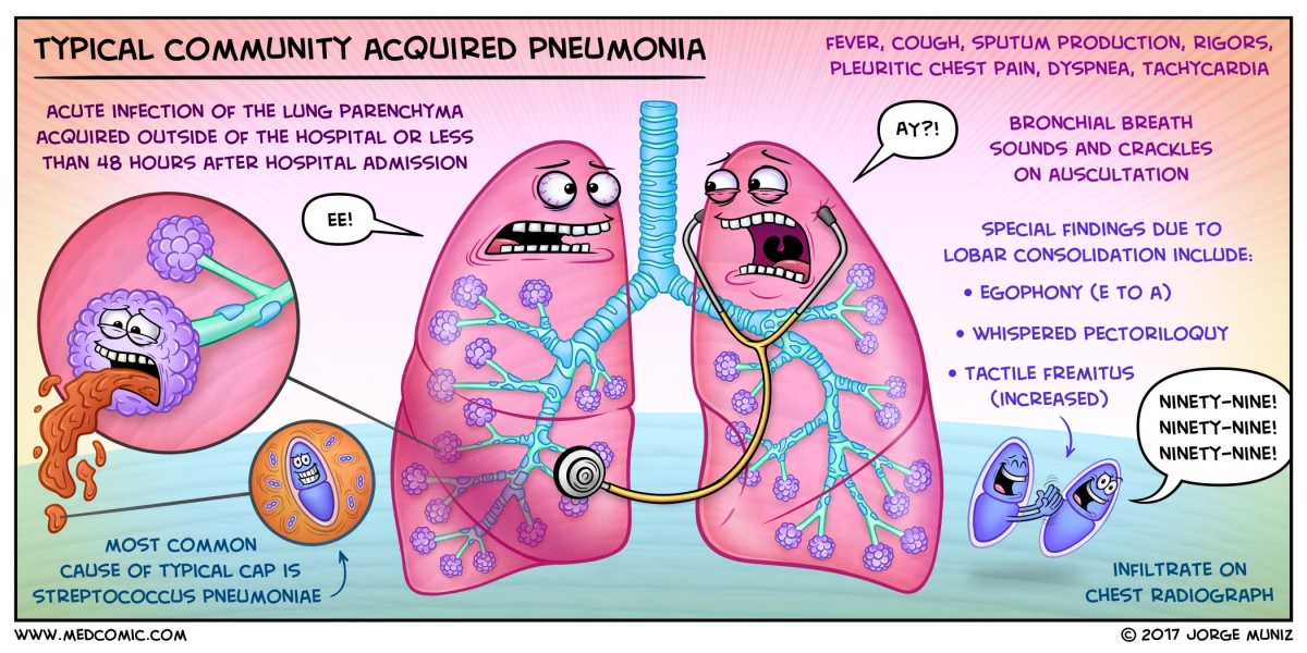 lung sounds in pneumonia