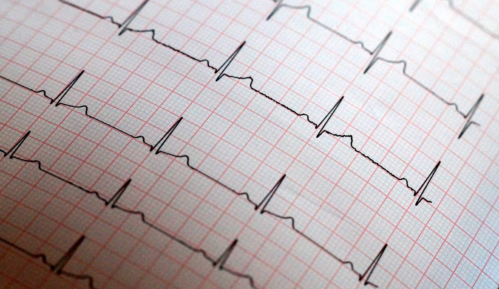 Ловит ритм. Ритм сердца на поверхности живота. ECG knowledge. Ритм сердца на 27 недели. Ritmi11c.