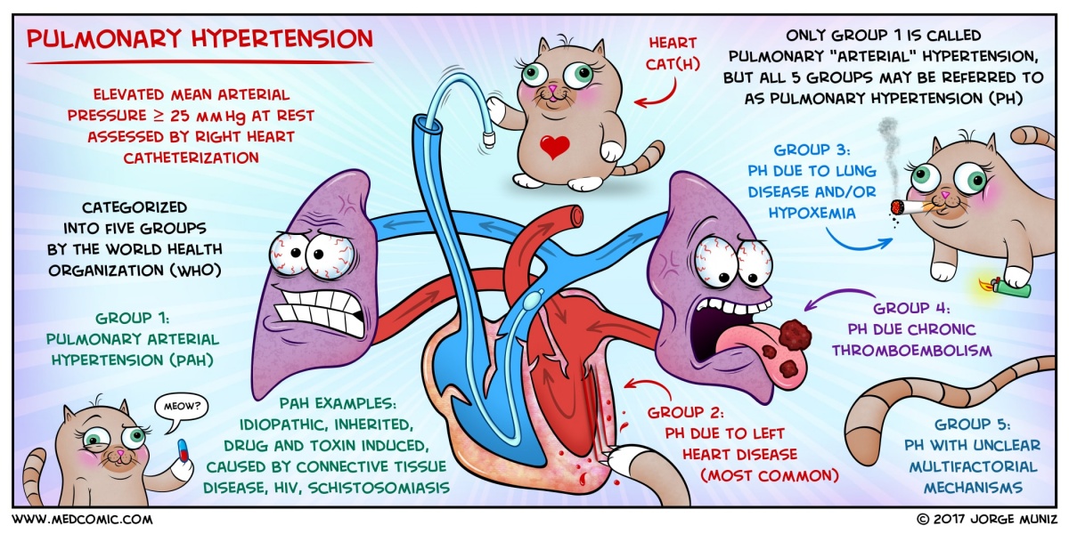 Learn Pulmonary Hypertension With A Medcomic Faculty of Medicine
