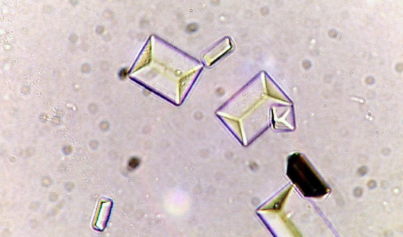 Types Of Crystals Found In Human Urine And Their Clinical Significance Faculty Of Medicine 6575