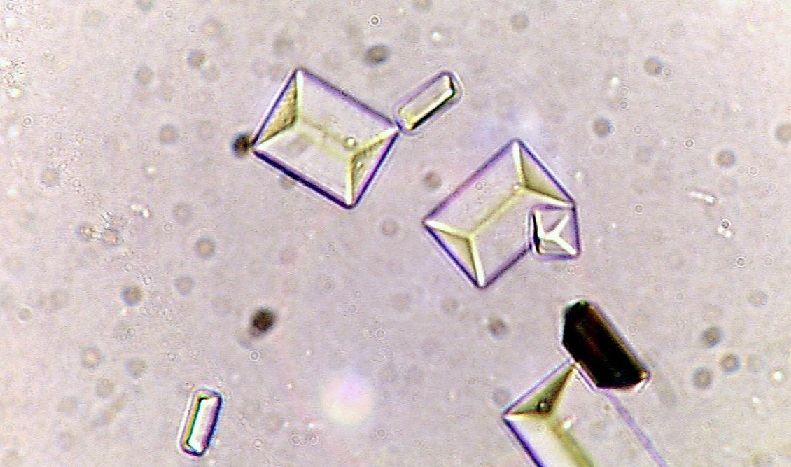 Types of Crystals Found In Human Urine and Their Clinical Significance ...