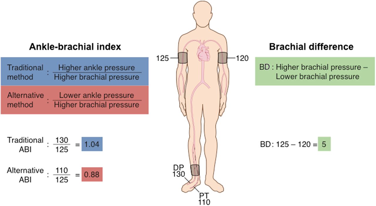 introduction-to-measuring-the-ankle-brachial-index-faculty-of-medicine