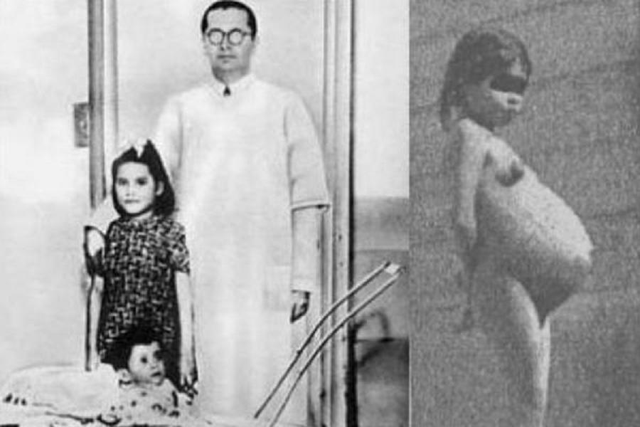 The Story Of Five-Year-Old Lina Medina, The Youngest Mother In The World.