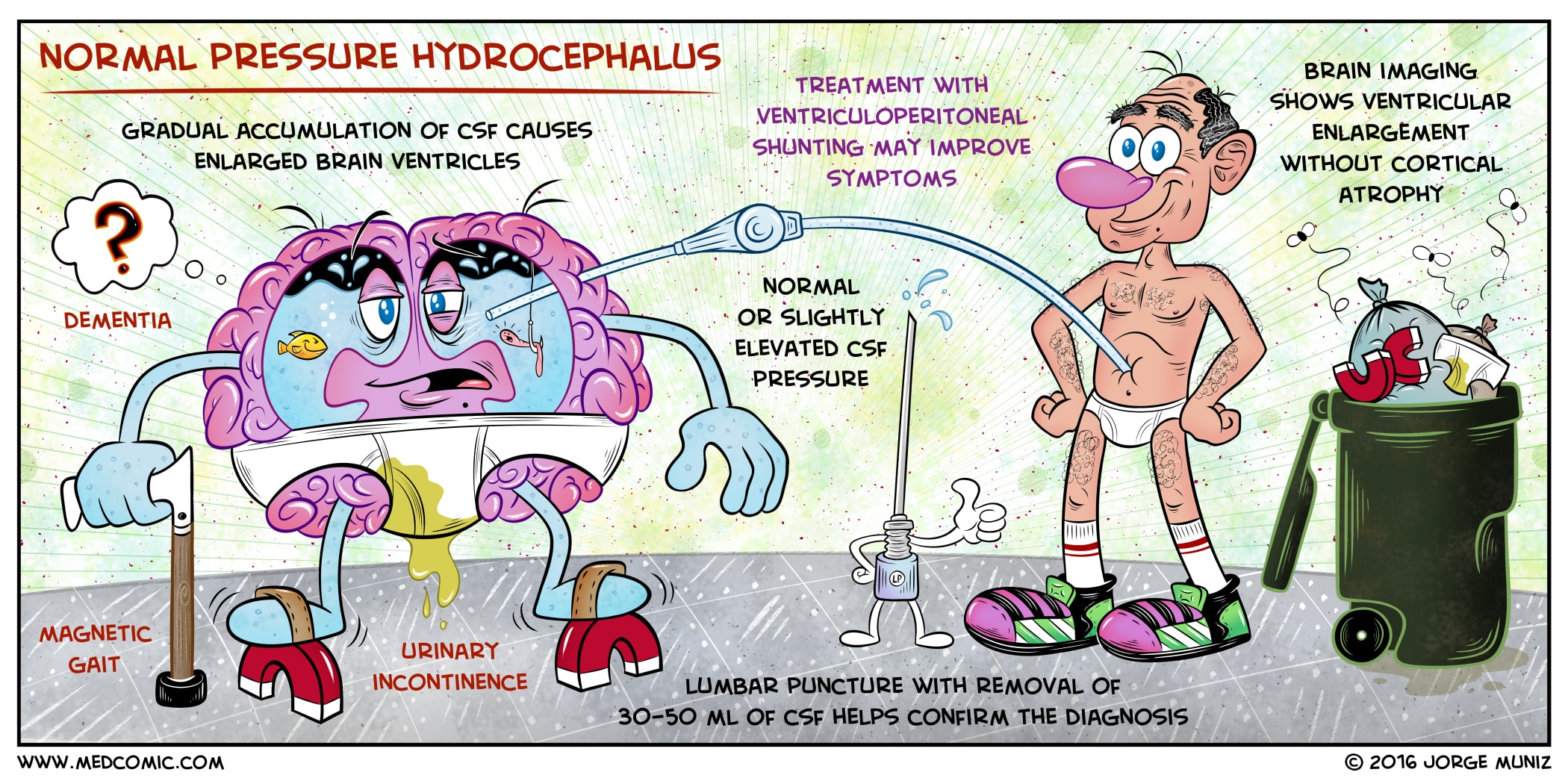 For Comic Lovers Fun Way To Study Normal Pressure Hydrocephalus 