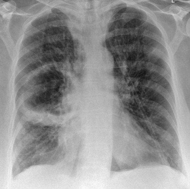 Chest Xray | Faculty of Medicine