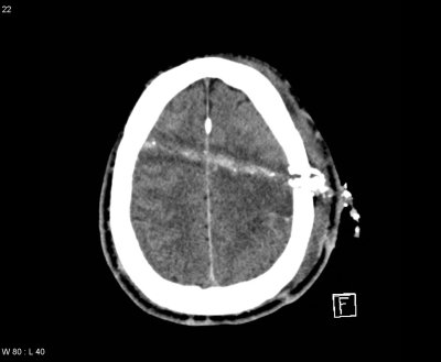 Axial-CT.jpg