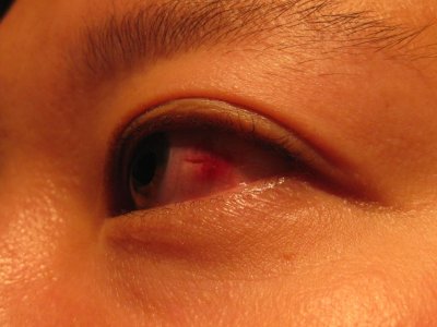 Ophthalmology Images.jpg
