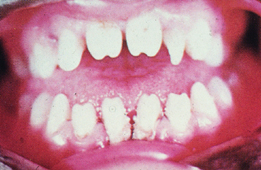 Dental Spot Diagnosis.jpg