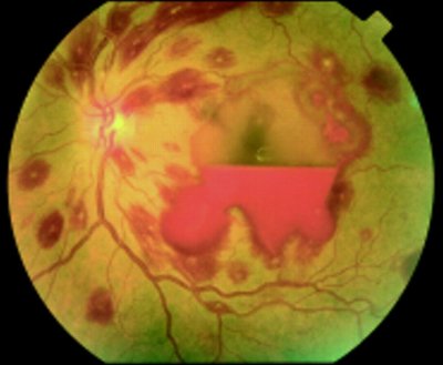 Opthalmology and Cardio.jpg