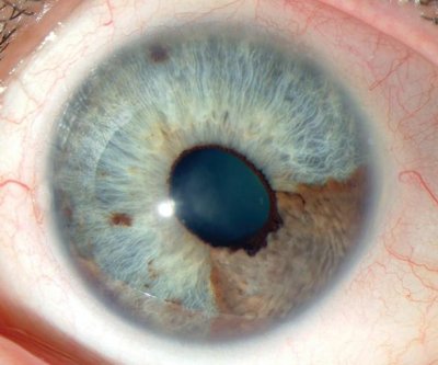 Ophthalmology Cases.jpg