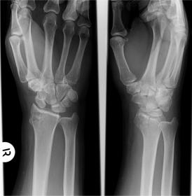 hand and wrist x-ray.jpg