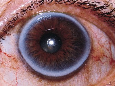 Ophthalmology Cases.jpg