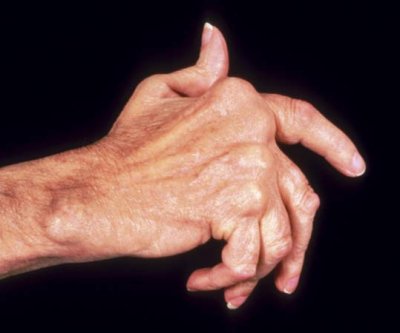 Rheumatology Cases.jpg