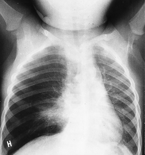 pediatric xray.jpg