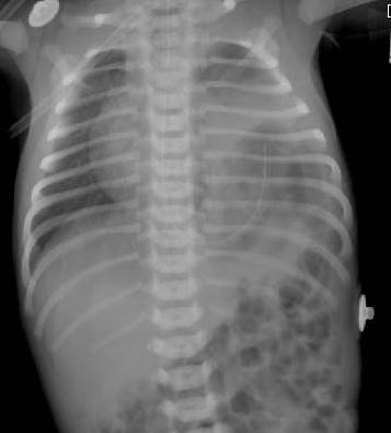 Pediatric Xray.jpg