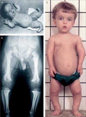 Paediatric Cases.jpg