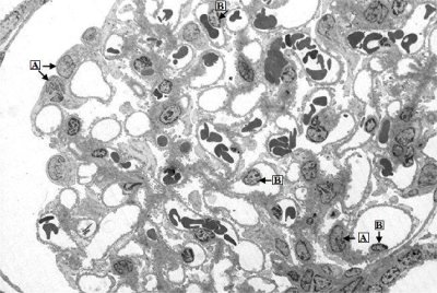 Glomerulus (EM).jpg