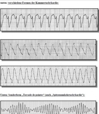 Notfall-EKG1.jpg