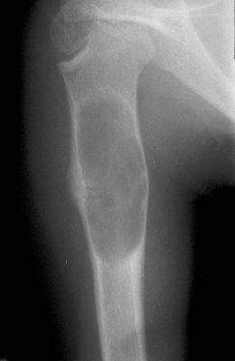 Bone Xray.jpg