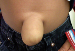 Abdomen.jpg