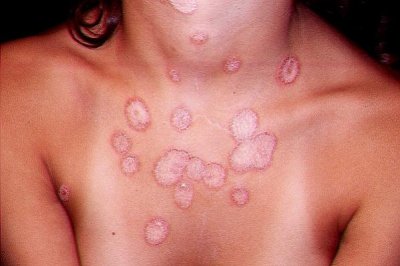 Dermatology Cases.jpg