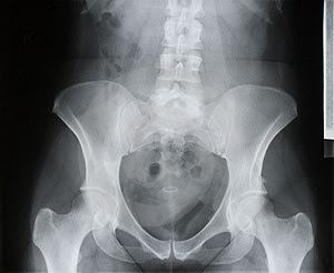 Xray Cases 2.jpg