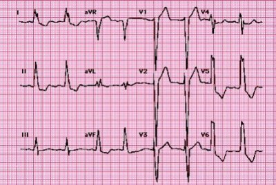 ECG Cases.jpg