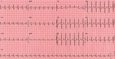 ecg images.jpg