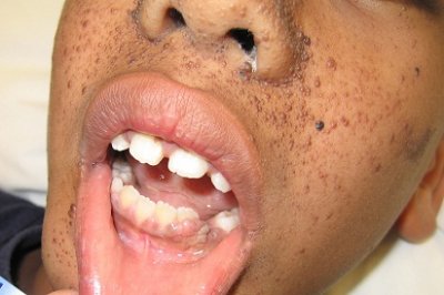 Derma Case.jpg