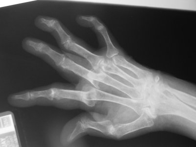 HAND XRAY.jpg