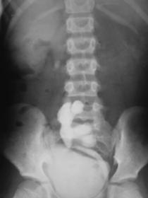 Abdomen Xray.jpg