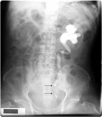 renal cases.jpg