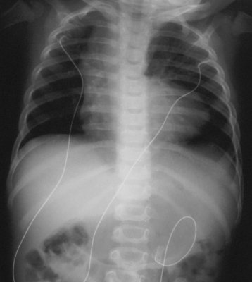 Pediatric Xray.jpg