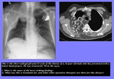 rare chest x ray.jpg