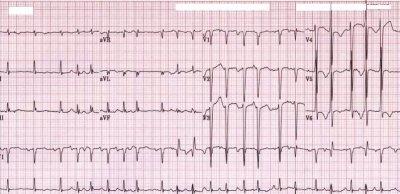 ECG1.jpg