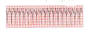 ECG.jpg