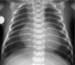 Chest Xray.jpg