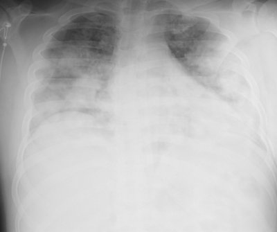 Spot Diagnosis | Faculty of Medicine