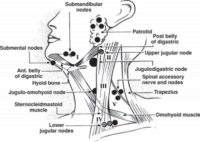 Diagnostic Approach to Different Causes of Neck Swellings | Faculty of ...