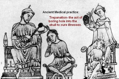 trepanation.JPG